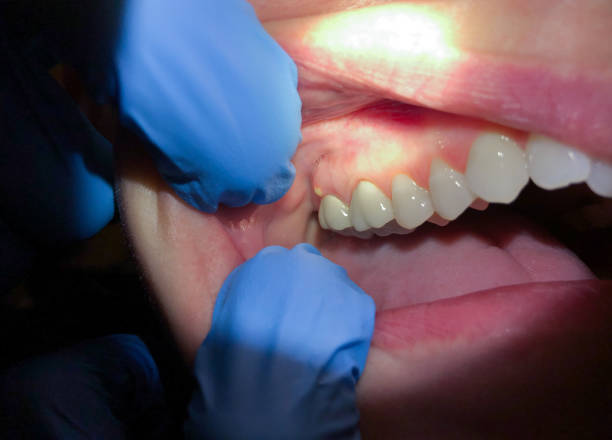 Best Emergency Dental Care for Trauma or Injury in Albion, IL